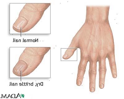 Hur ta hand om dina naglar. Vid tillämpning av lotion på händerna bör du gnida lite i och runt naglarna.
